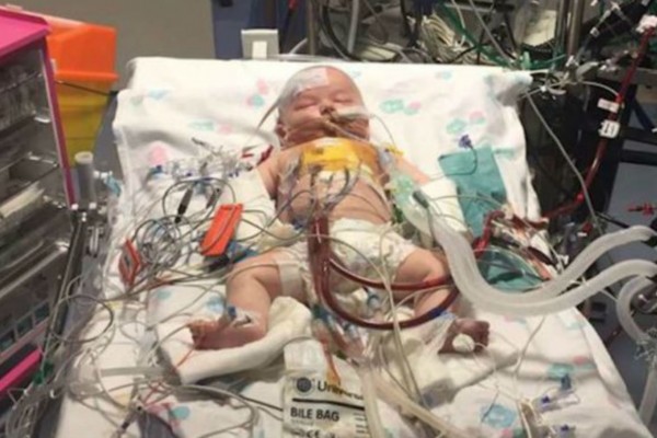 Η καρδιά ενός μωρού σταμάτησε για 15 ώρες - 9 μήνες μετά... (Video) - Περίεργα-Funny